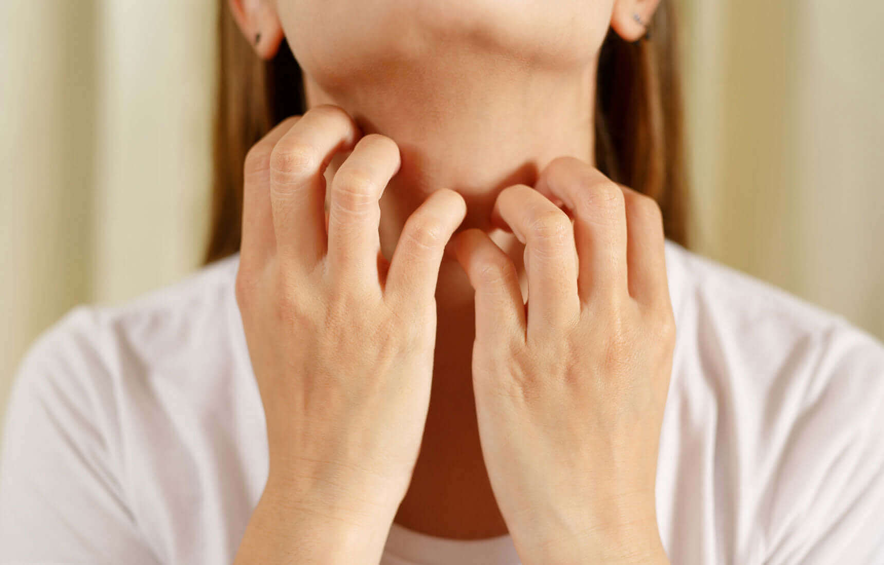 A person experiencing skin irritation and redness on their neck, illustrating common symptoms of a nickel allergy from non-hypoallergenic jewelry.